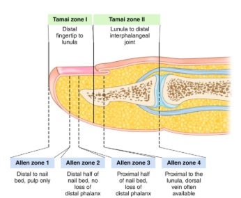 Lipoma