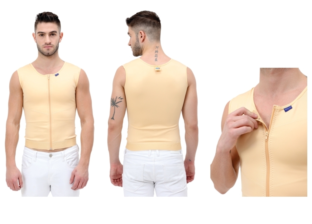 Gynaecomastia