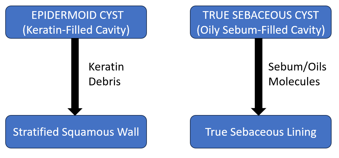 SebaceousCyst