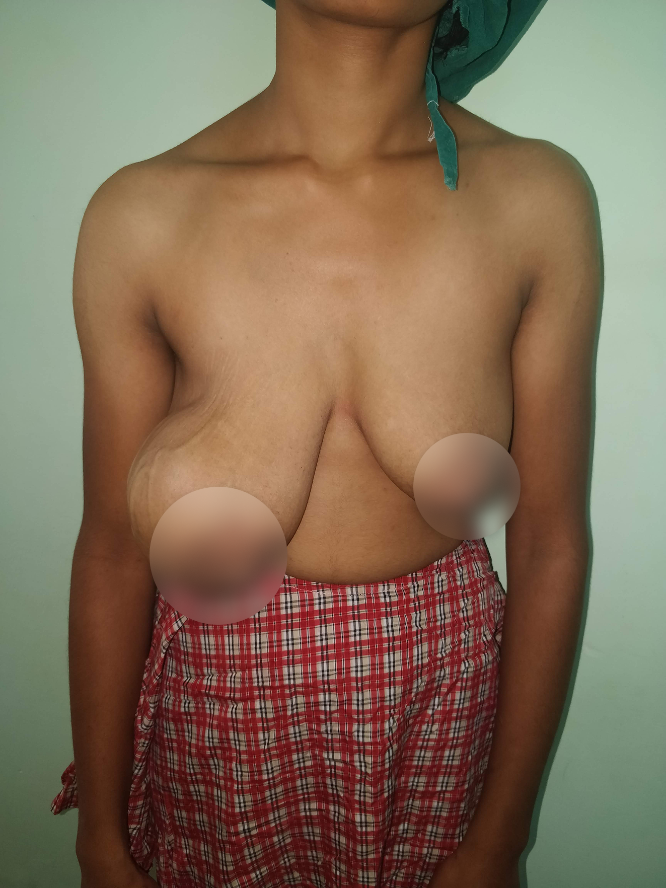 img1