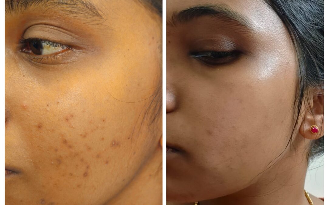 What are the non-surgical options to brighten the face?